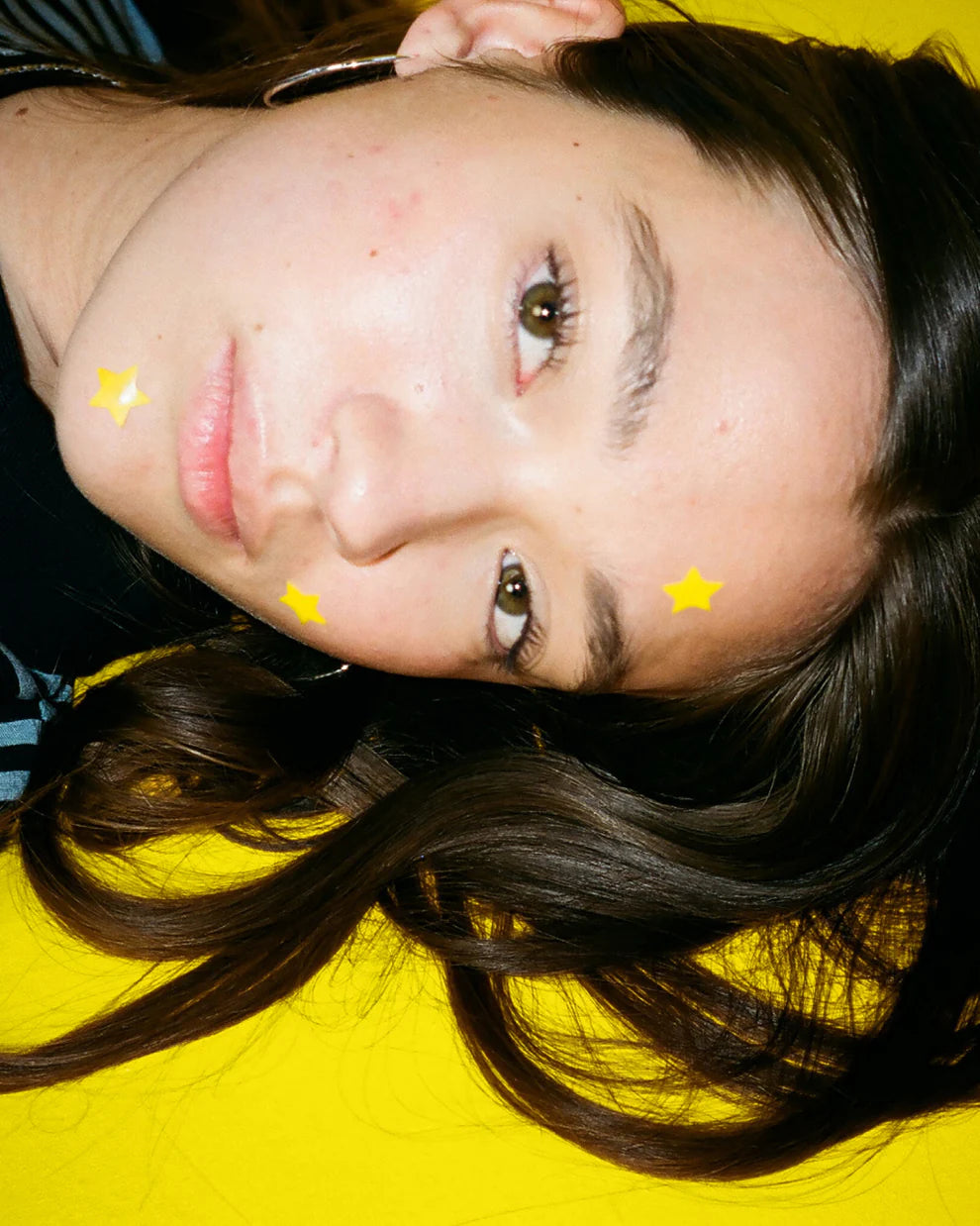 Starly Yellow — Parches para Granitos (40)