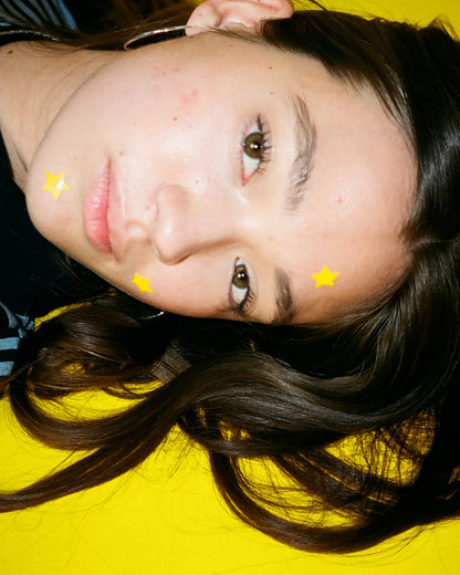 Starly Yellow — Parches para Granitos (40)