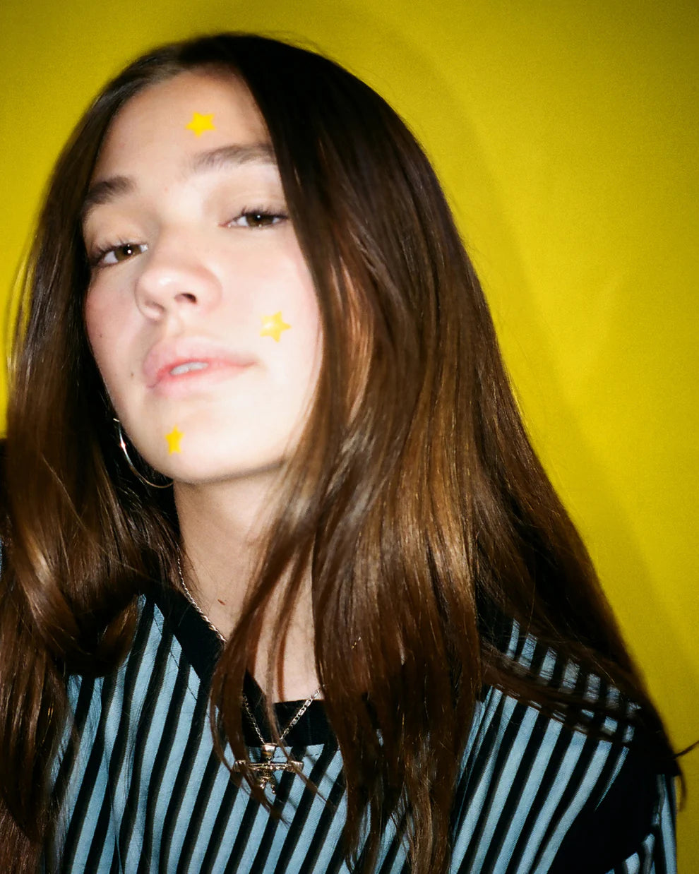 Starly Yellow — Parches para Granitos (40)